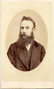 Carte de Visite from the Edinburgh Studio of Thomas Buist  -  Man with Beard